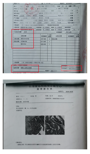 膀胱癌.png